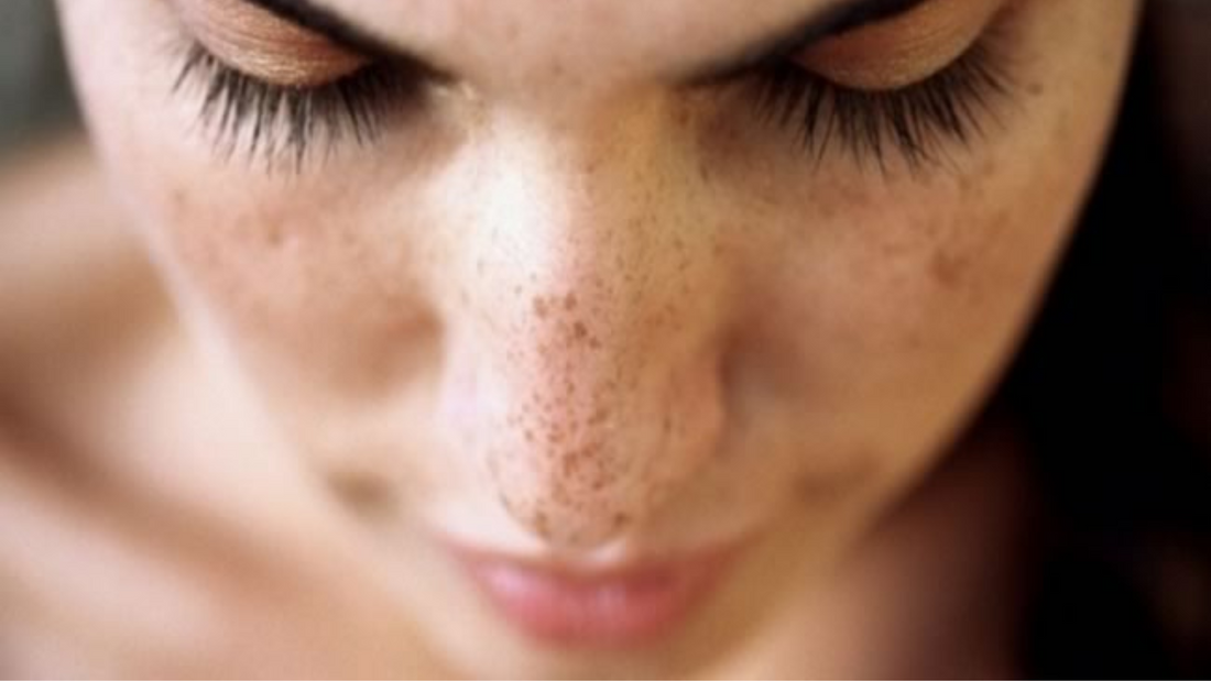 What are sun spots?