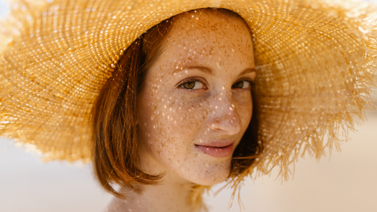 Solbari blog: What is photocontact eczema?