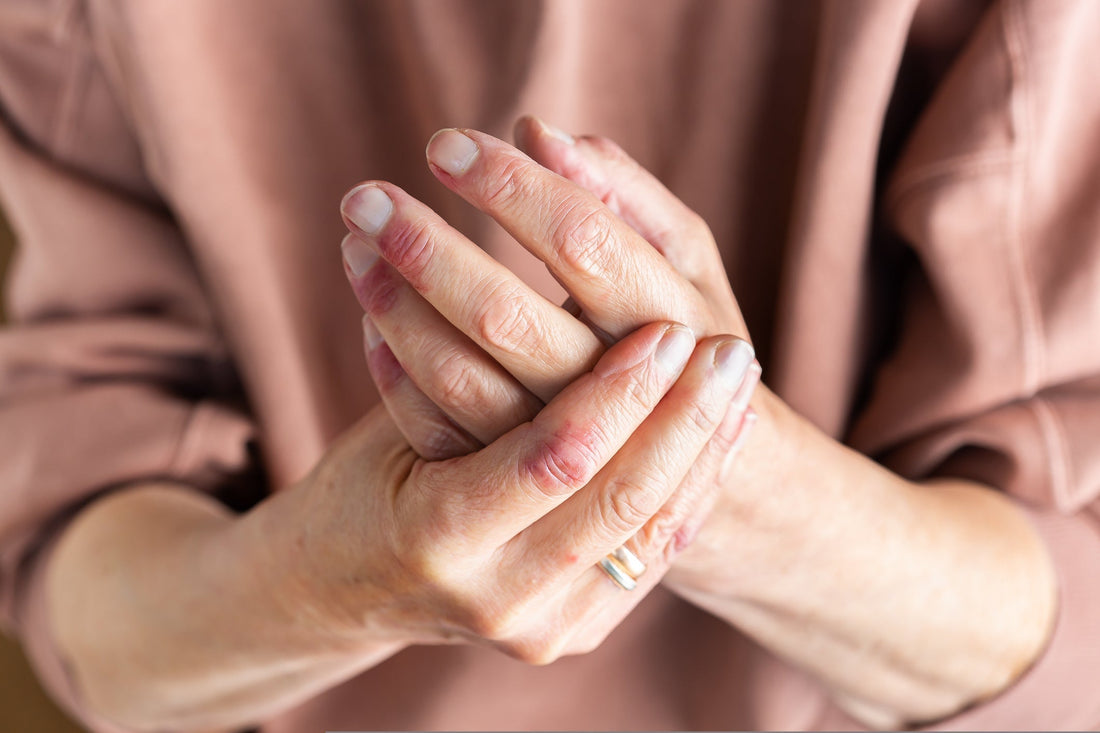 Solbari awarded inaugural Seal of Recognition from the National Psoriasis Foundation